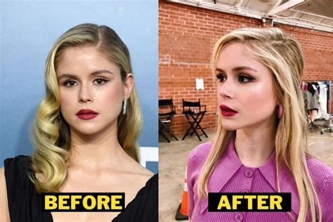 erin moriarty after surgery|Erin Moriarty Responds to Plastic Surgery Backlash